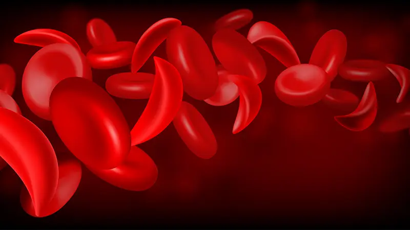 Sickle Cell Data Analysis Request